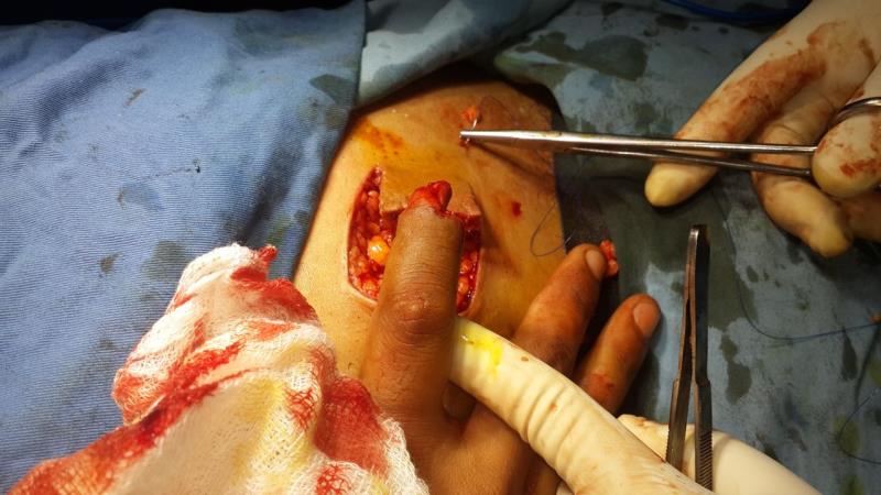 Varicose and more