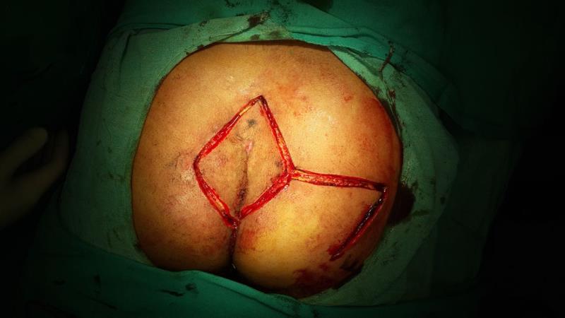 Varicose and more