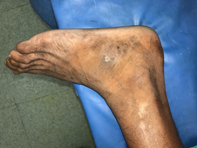 Varicose and more