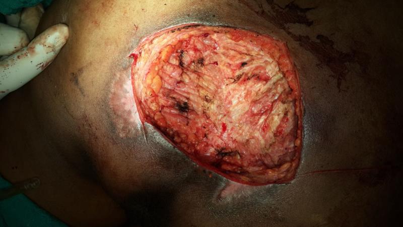 Varicose and more