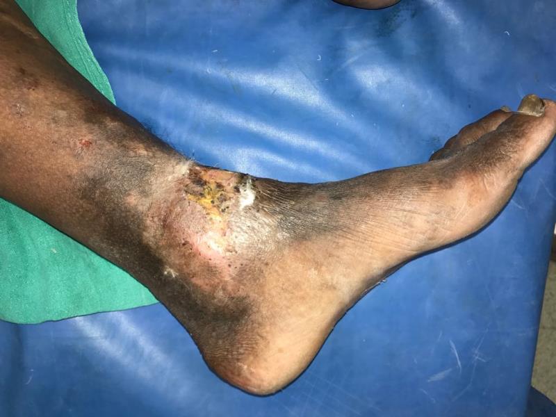 Varicose and more