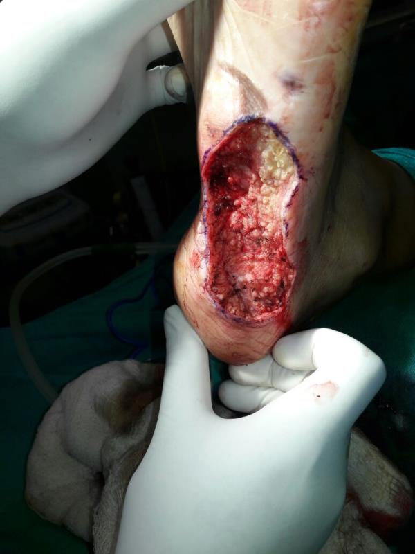 Varicose and more