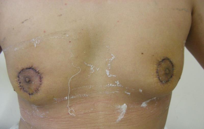 Varicose and more