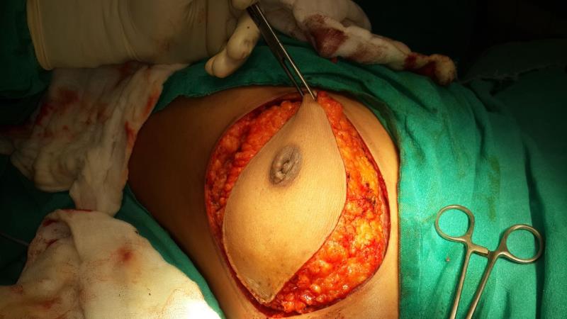 Varicose and more