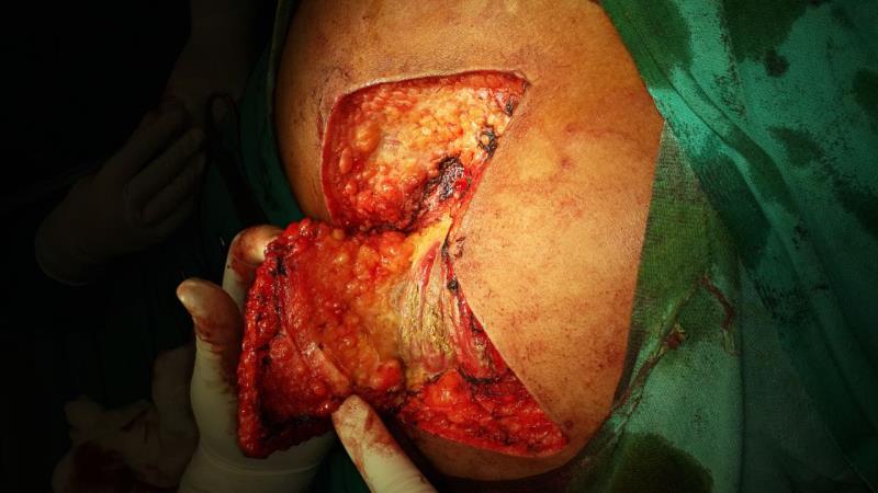 Varicose and more
