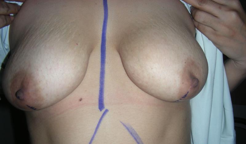 Varicose and more