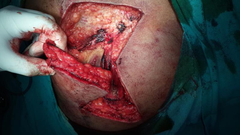 Varicose and more