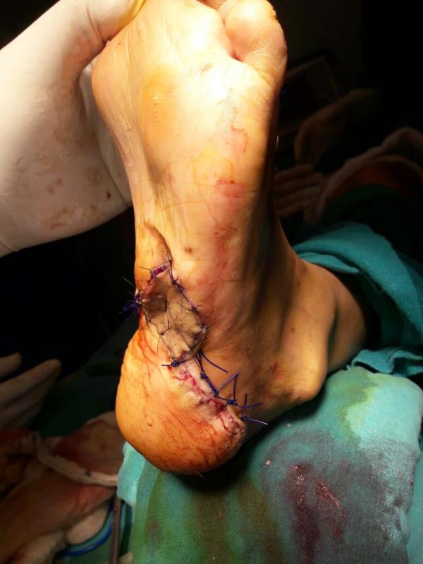 Varicose and more