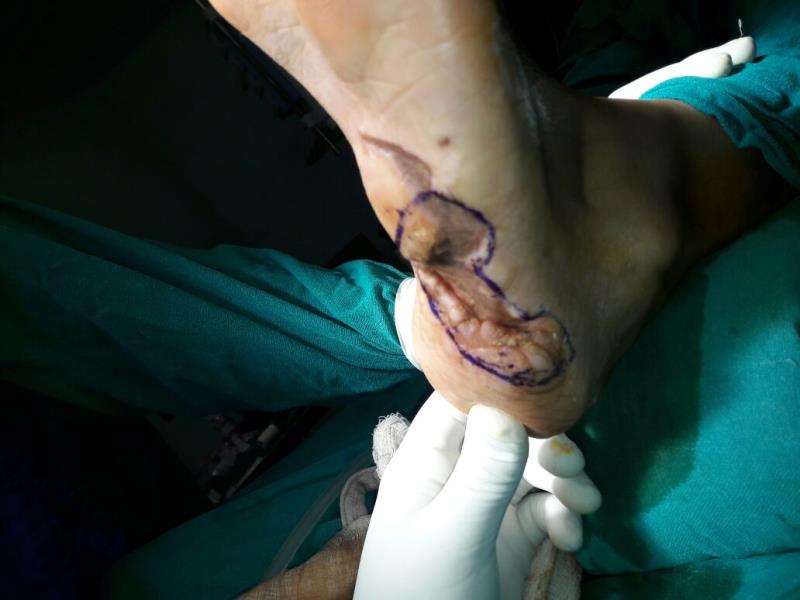 Varicose and more