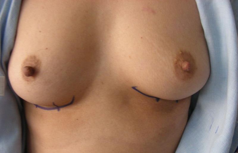 Varicose and more