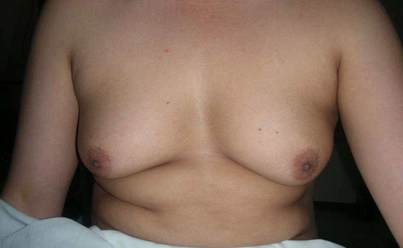 Varicose and more
