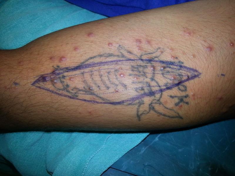 Varicose and more