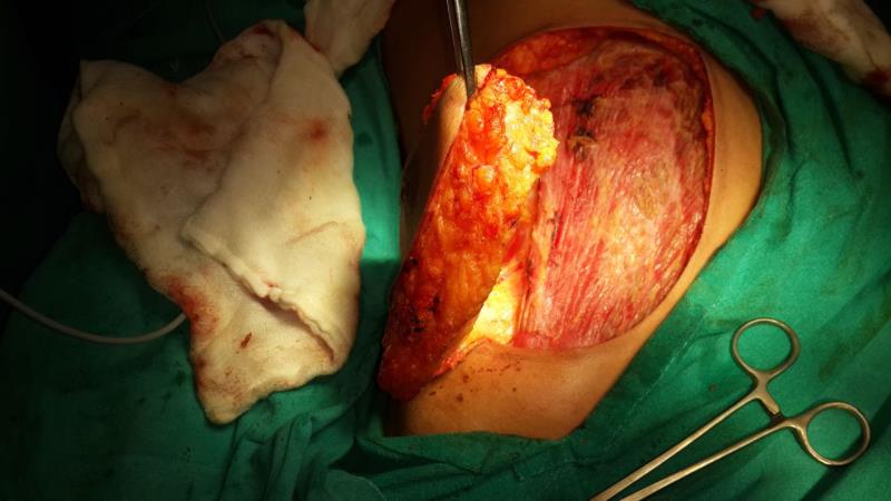 Varicose and more