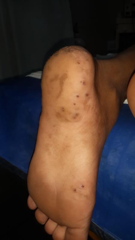 Varicose and more