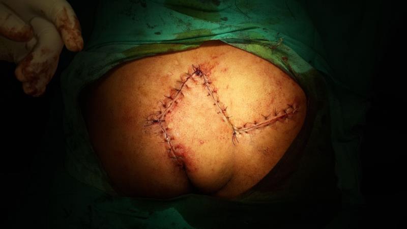 Varicose and more