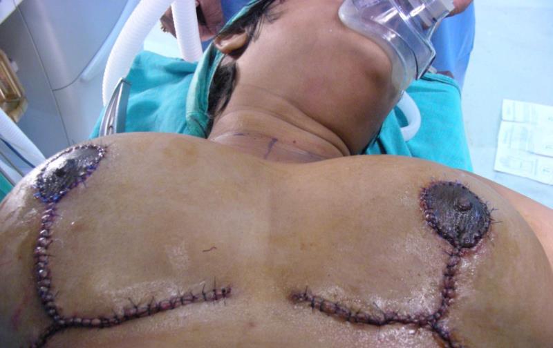 Varicose and more