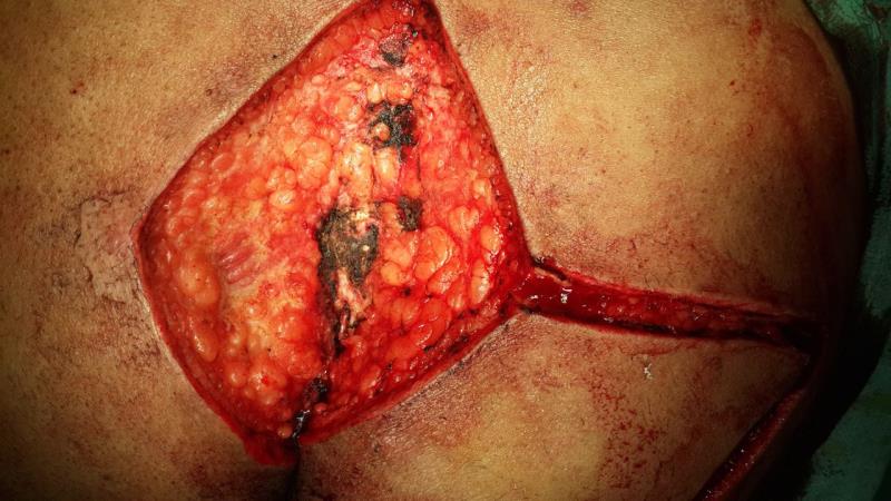 Varicose and more