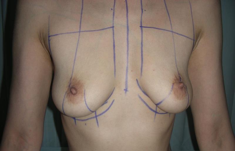 Varicose and more