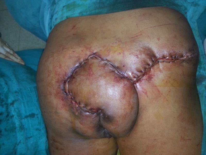 Varicose and more