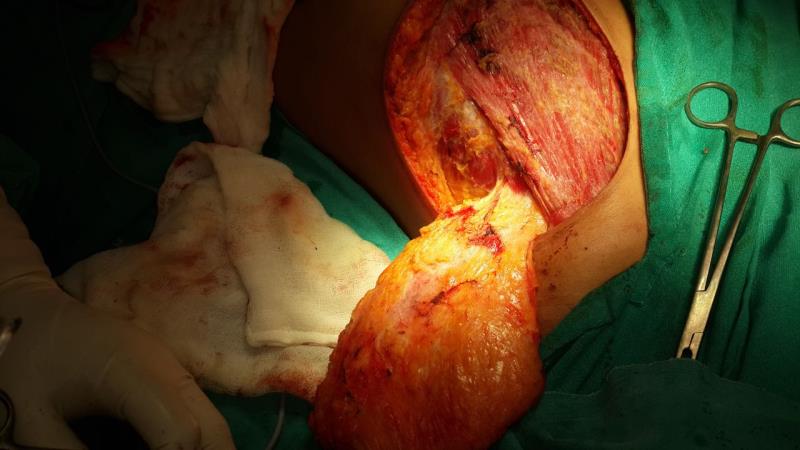 Varicose and more