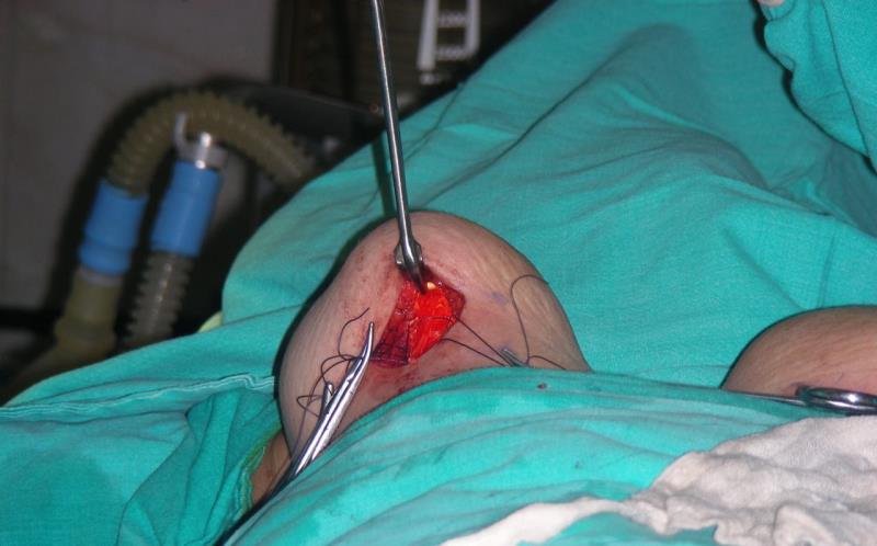 Varicose and more