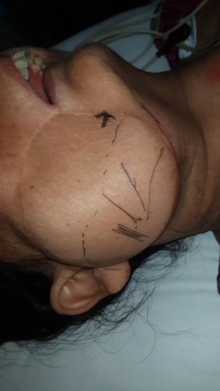 Varicose and more