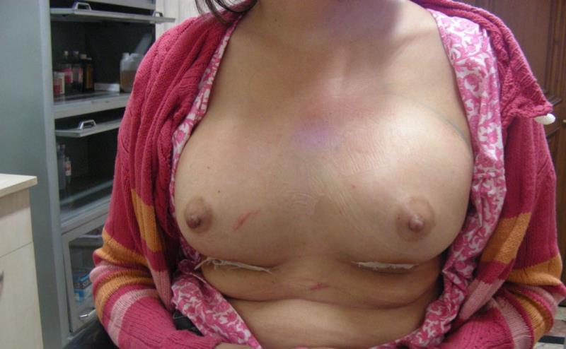 Varicose and more