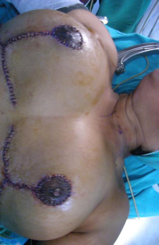 Varicose and more