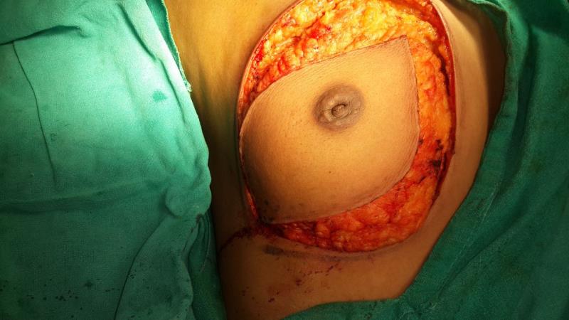 Varicose and more