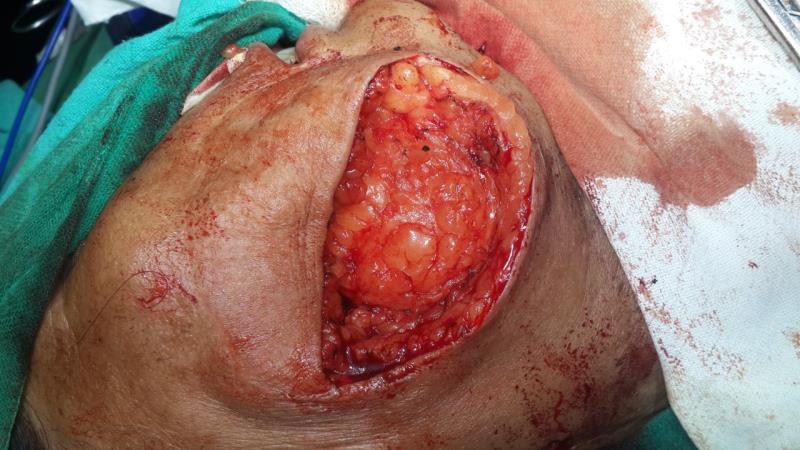 Varicose and more