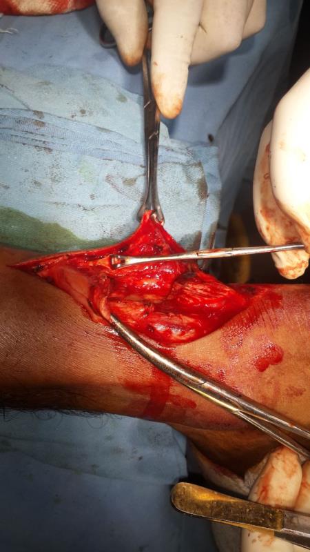 Varicose and more