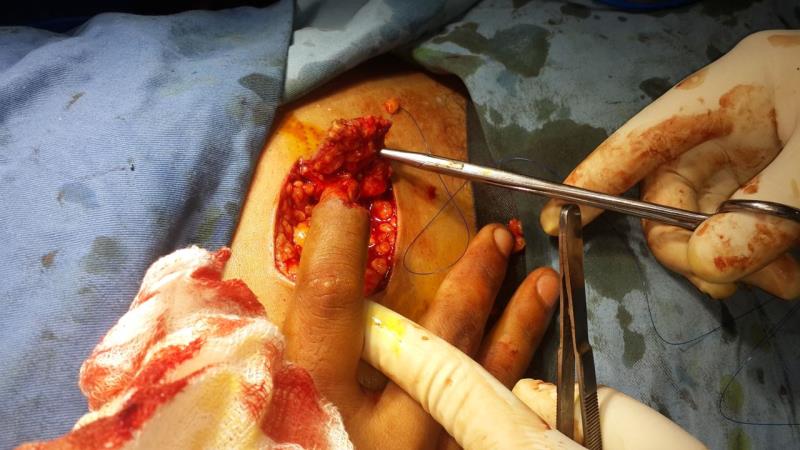 Varicose and more