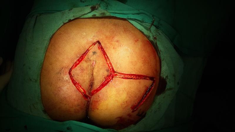 Varicose and more