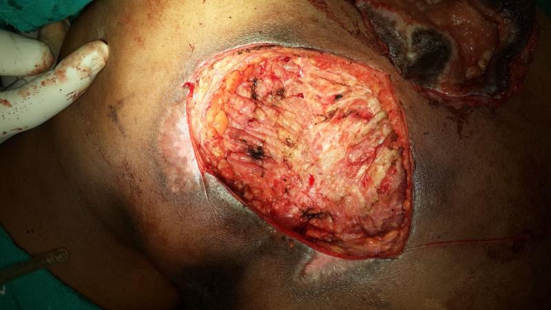 Varicose and more