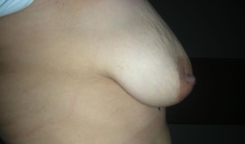Varicose and more