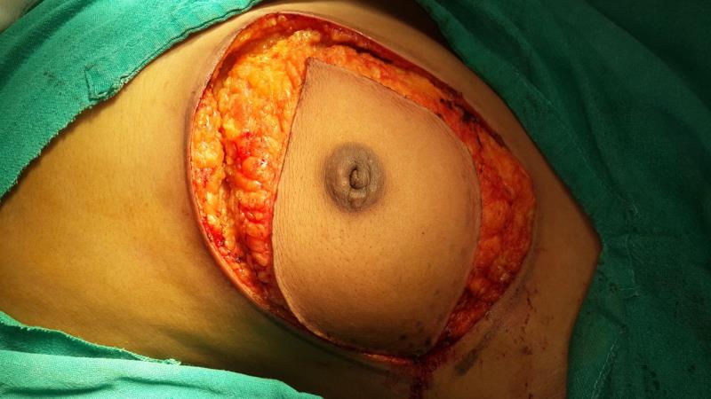 Varicose and more