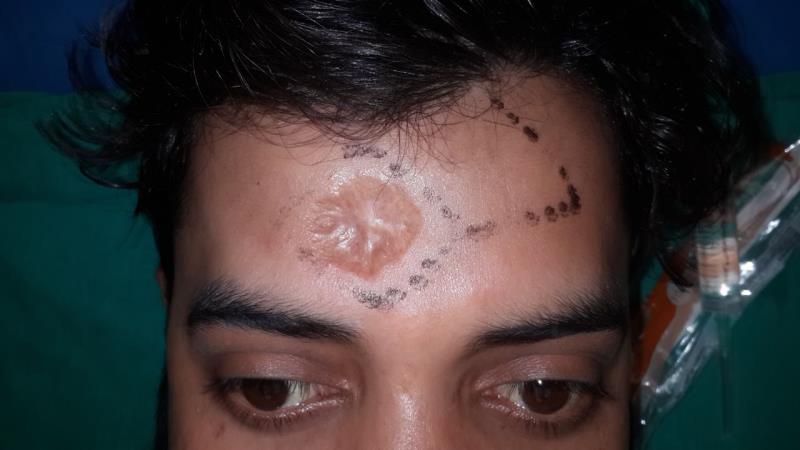 Varicose and more