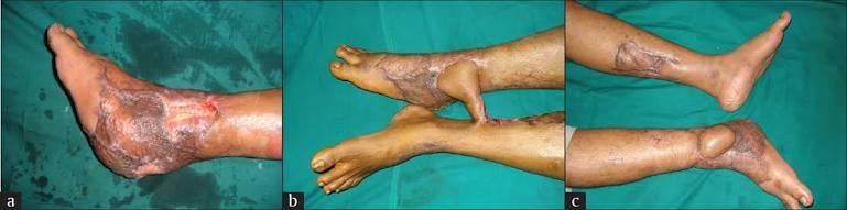 Varicose and more