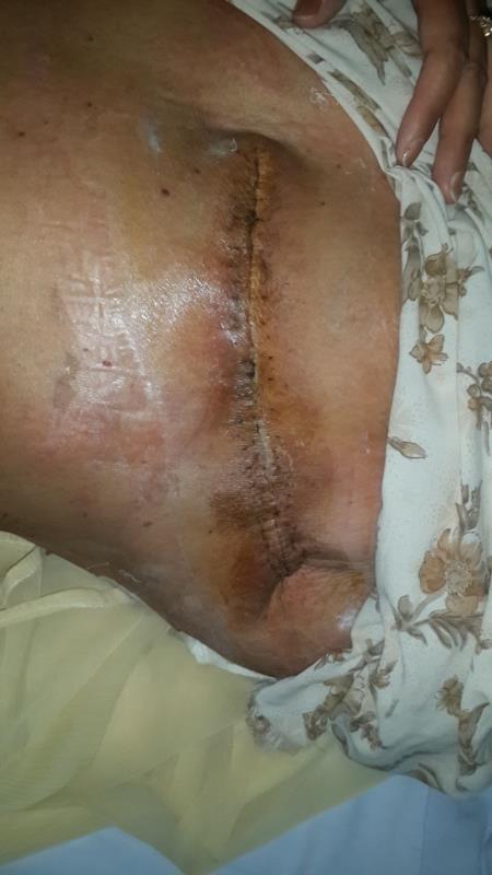 Varicose and more