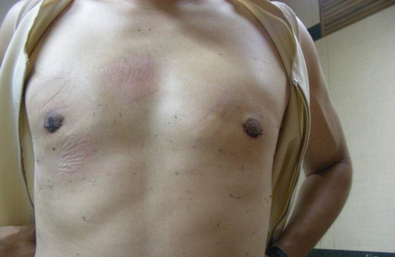 Varicose and more