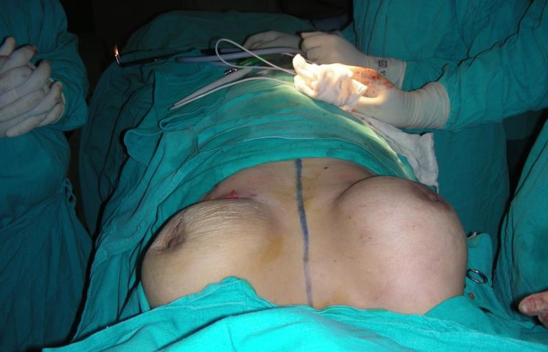 Varicose and more