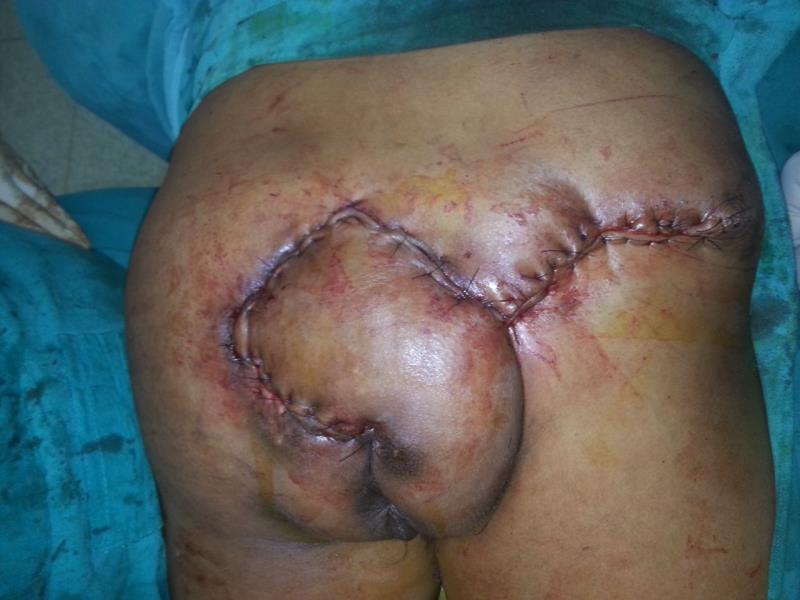 Varicose and more