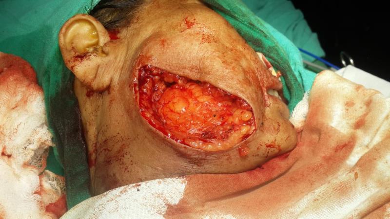Varicose and more