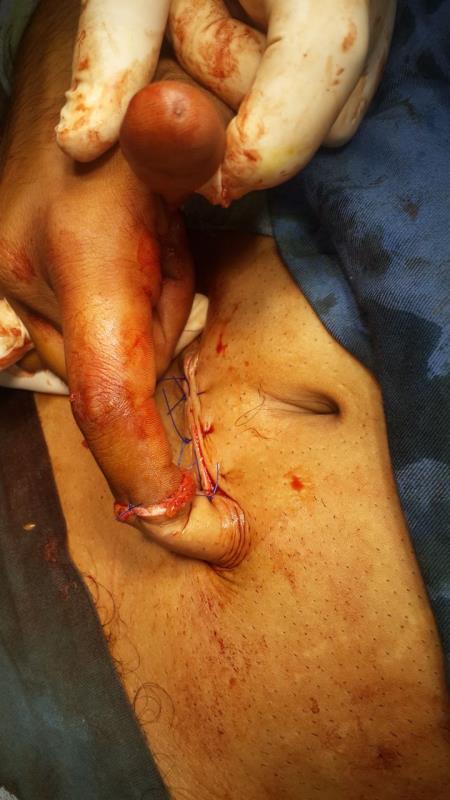 Varicose and more