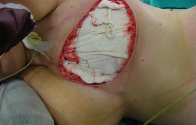 Varicose and more