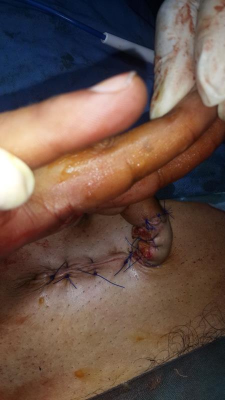 Varicose and more