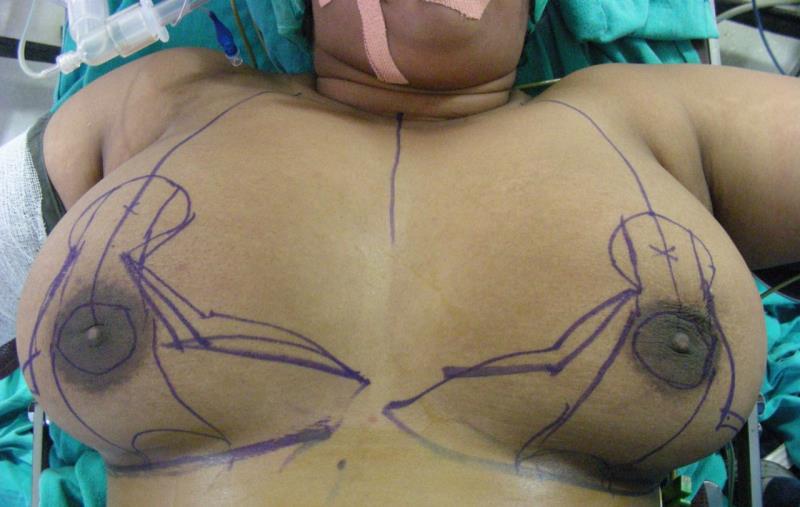 Varicose and more