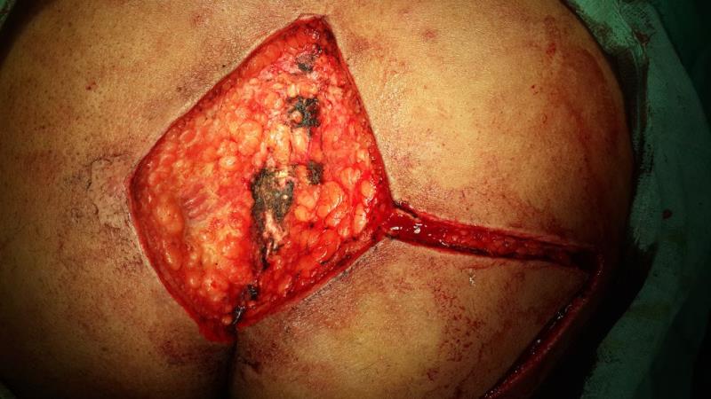Varicose and more