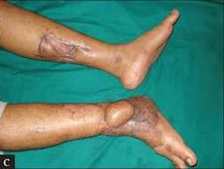Varicose and more