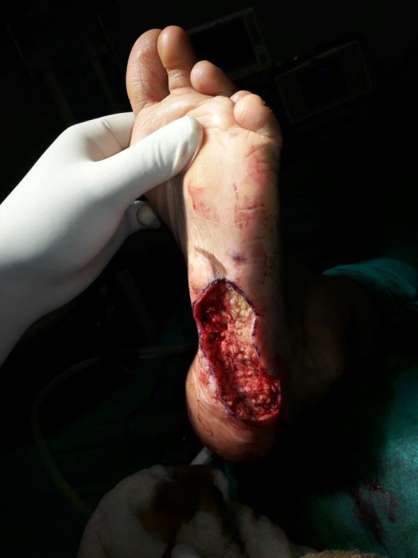 Varicose and more